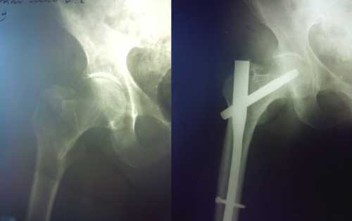 К первой группе относят