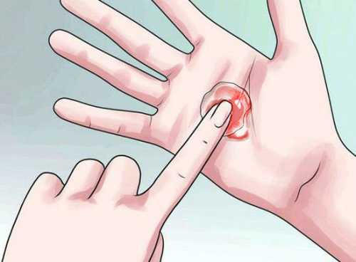 Если же их характер регулярный, они присутствуют в каждом цикле, то это повод для обращения за консультацией к гинекологу