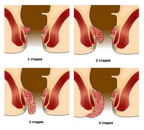 Наблюдение в течение нескольких циклов поможет выявить характерные изменения выделений при выходе зрелой яйцеклетки увеличение количества выделенийвыделенияпо консистенции похожи на яичный белок возможно наличие кровяных вкраплений