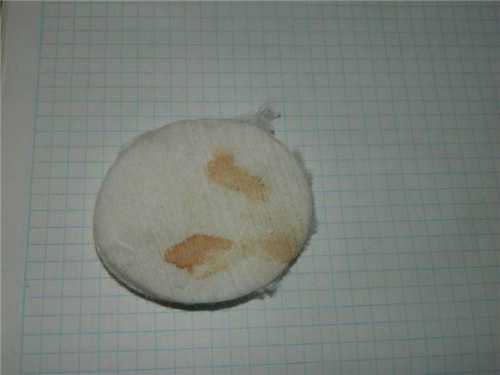 Но только если они не зловонны, не вызывают желания чесаться, не создают ощущения жжения