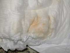 Выделения не приводят к дискомфорту, не вызывают у будущей матери желания чесаться, чувство жжения