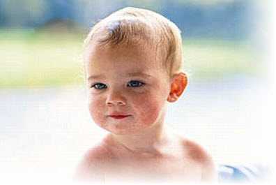 У одних малышей появляются плотные желтые корочки, у других тоненькие белые, похожие на слипшуюся перхоть