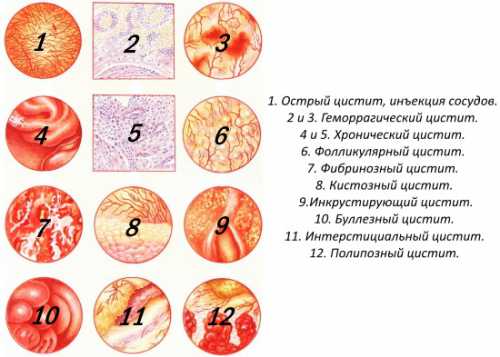 Ни одна мать не желает, чтобы изза ее необдуманных решений страдал ее ребенок