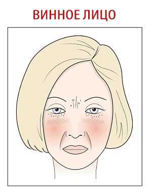 Девушка испытывает постоянное раздражение