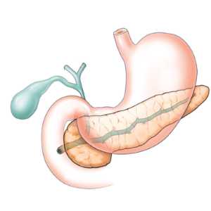 Что такое панкреатит
