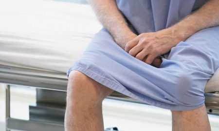 Лечение фимоза у мужчин в домашних условиях: