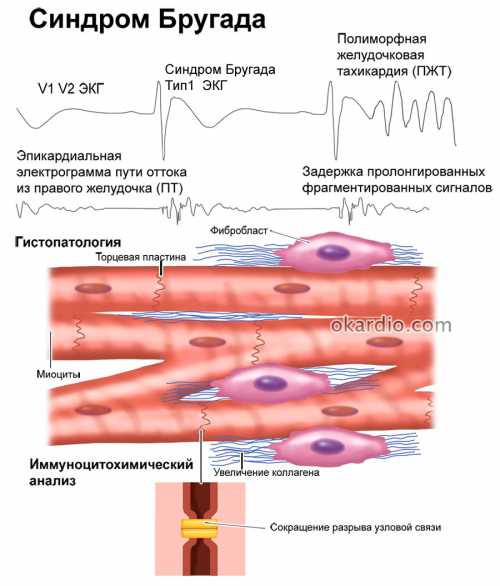 Отсутствия боли