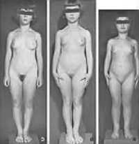 Во время пубертатного периода под влиянием высокого уровня женских гормонов кости таза растут в ширину