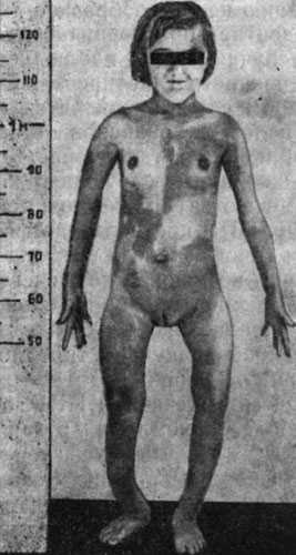 Довольно часто все это сопровождается низкой самооценкой и недовольством своим внешним видом