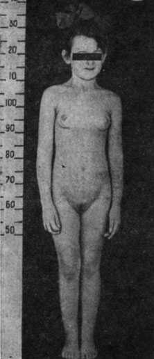 Половое развитие