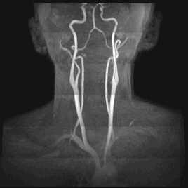 Процедура исследования при