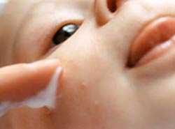 Аллергия у детей