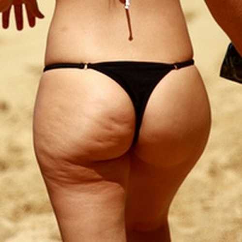 Такой самомассаж также улучшает приток крови и кислорода, что помогает сократить проявления целлюлита