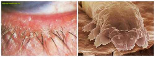 Черновцы , , Новости