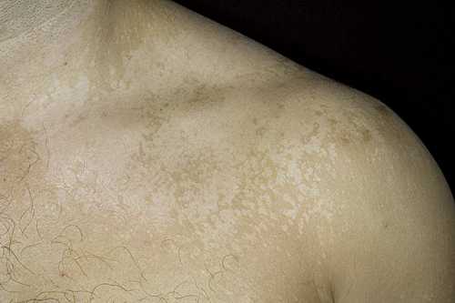 Известно, что в составе этого продукта содержится очень много полезных витаминов и микроэлементов