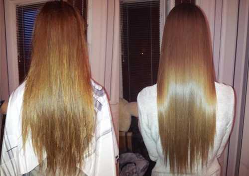 Сейчас, уже после третьей процедуры, думаю, что могу претендовать на какуюто объективность и обобщить какойто, пусть даже свой личный, опыт